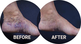When are Varicose Veins More Than Just a Cosmetic Concern?: Vascular  Institute of New York: Board Certified Vascular and Endovascular Surgeons